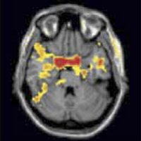 /images/staff/images/amygdala.jpg