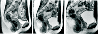 /images/staff/images/vrouwdoorsnede.gif